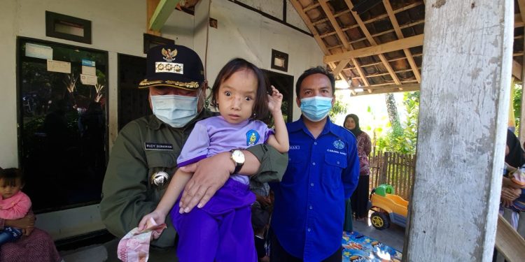 Pemkab Garut Kerahkan Seluruh SKPD dan Kecamatan Lakukan Penyisiran Anak Bergizi Buruk