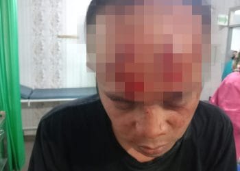 Pasca Terjadi Kericuhan, Bupati Garut Ancam Pertandingan Liga Desa Dihentikan