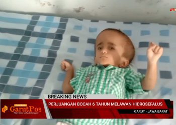 VIDEO: Kisah Alfa Muzakir Bocah Penderita Hidrosefalus di Garut Yang Butuh Uluran Tangan