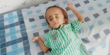 Kisah Anak Pengidap Hindosefalus di Garut Yang Tak Mampu Melanjutkan Berobat Karena Menunggak Iuran BPJS Hingga 6 Juta