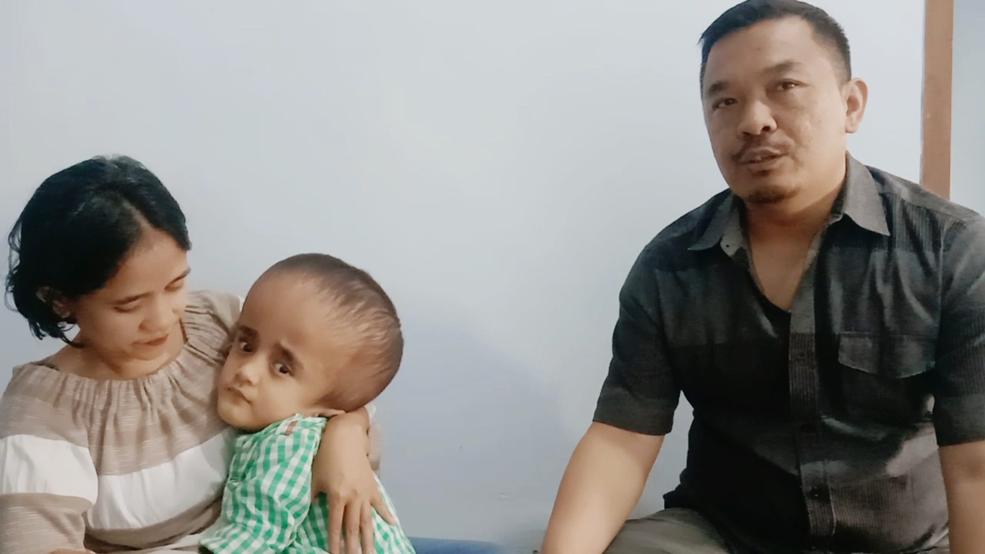 Kisah Anak Pengidap Hindosefalus di Garut Yang Tak Mampu Melanjutkan Berobat Karena Menunggak Iuran BPJS Hingga 6 Juta